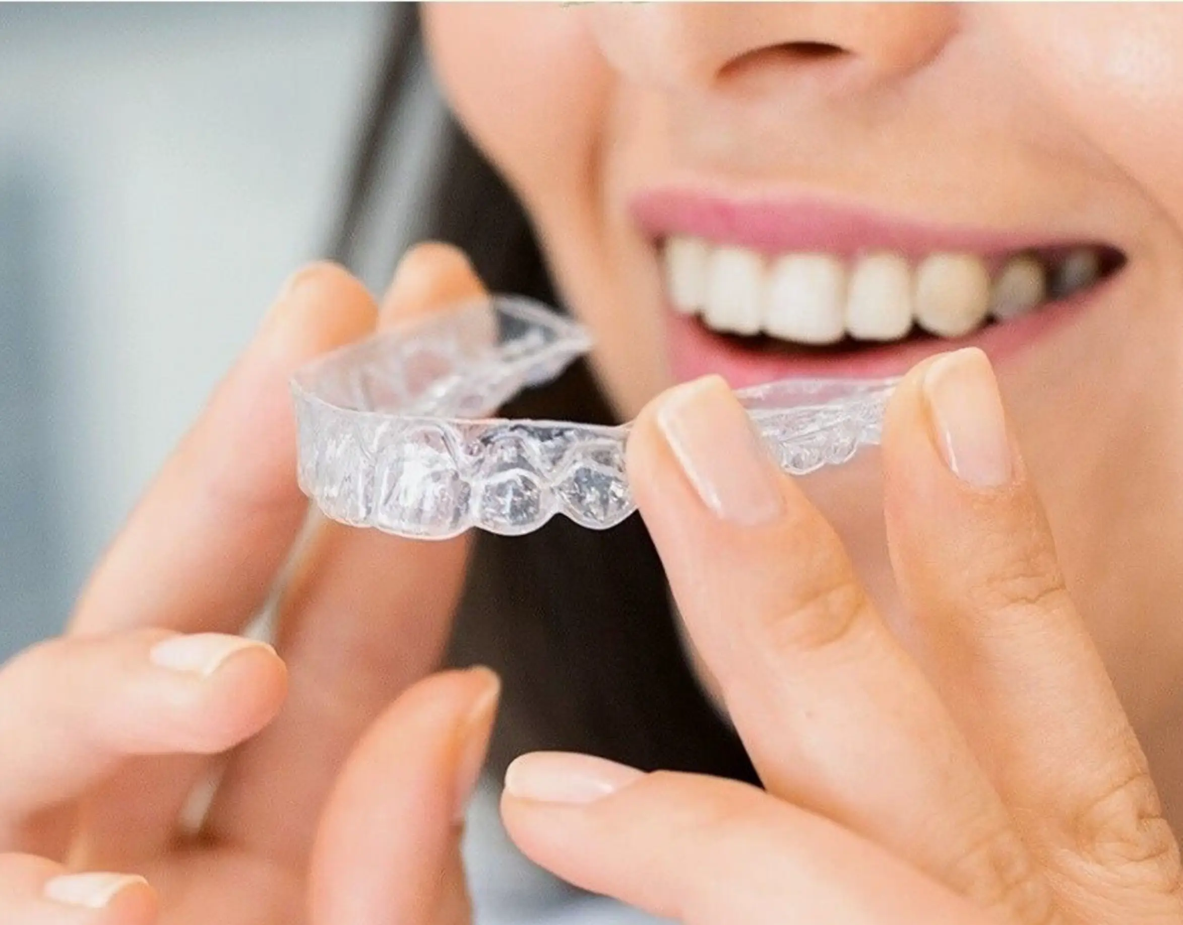 Advanced diagnostic clear aligner scanning