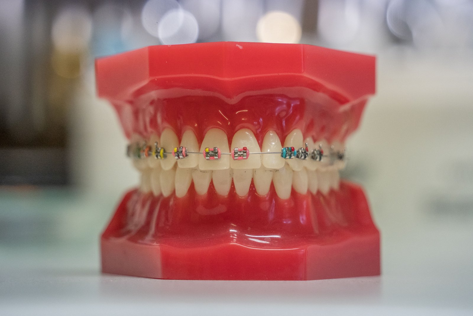 Advanced diagnostic orthodontic mapping