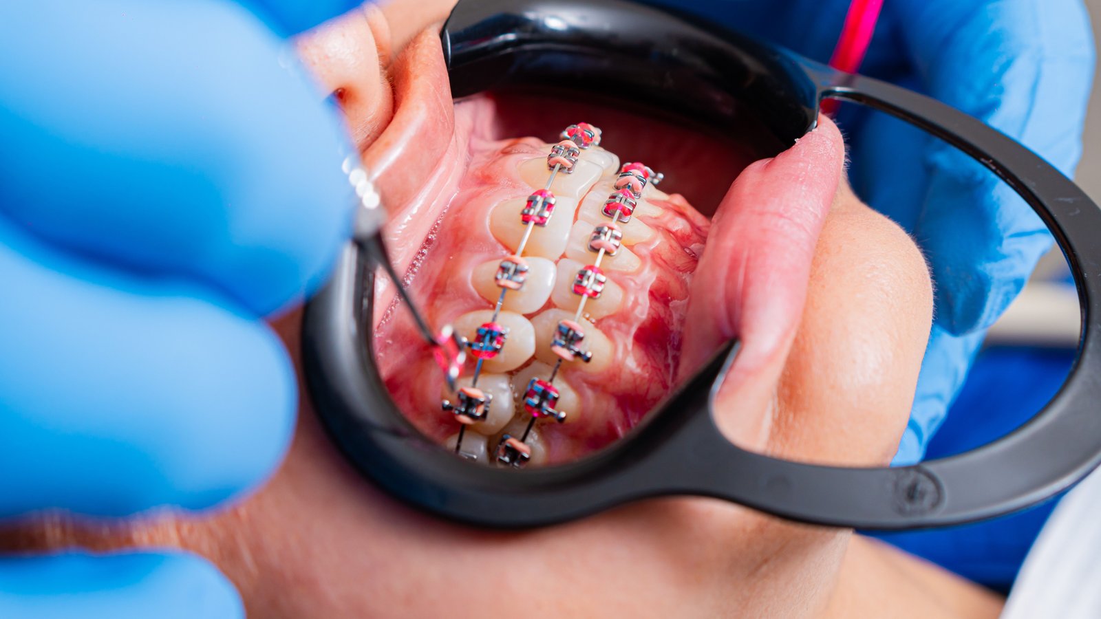 Advanced diagnostic orthodontic mapping
