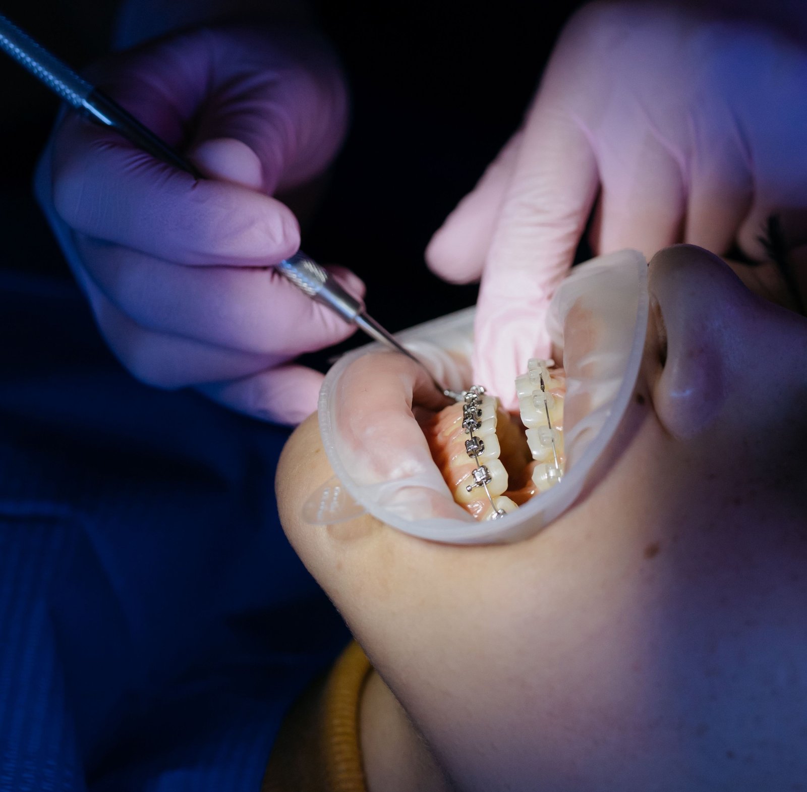Advanced diagnostic orthodontic mapping