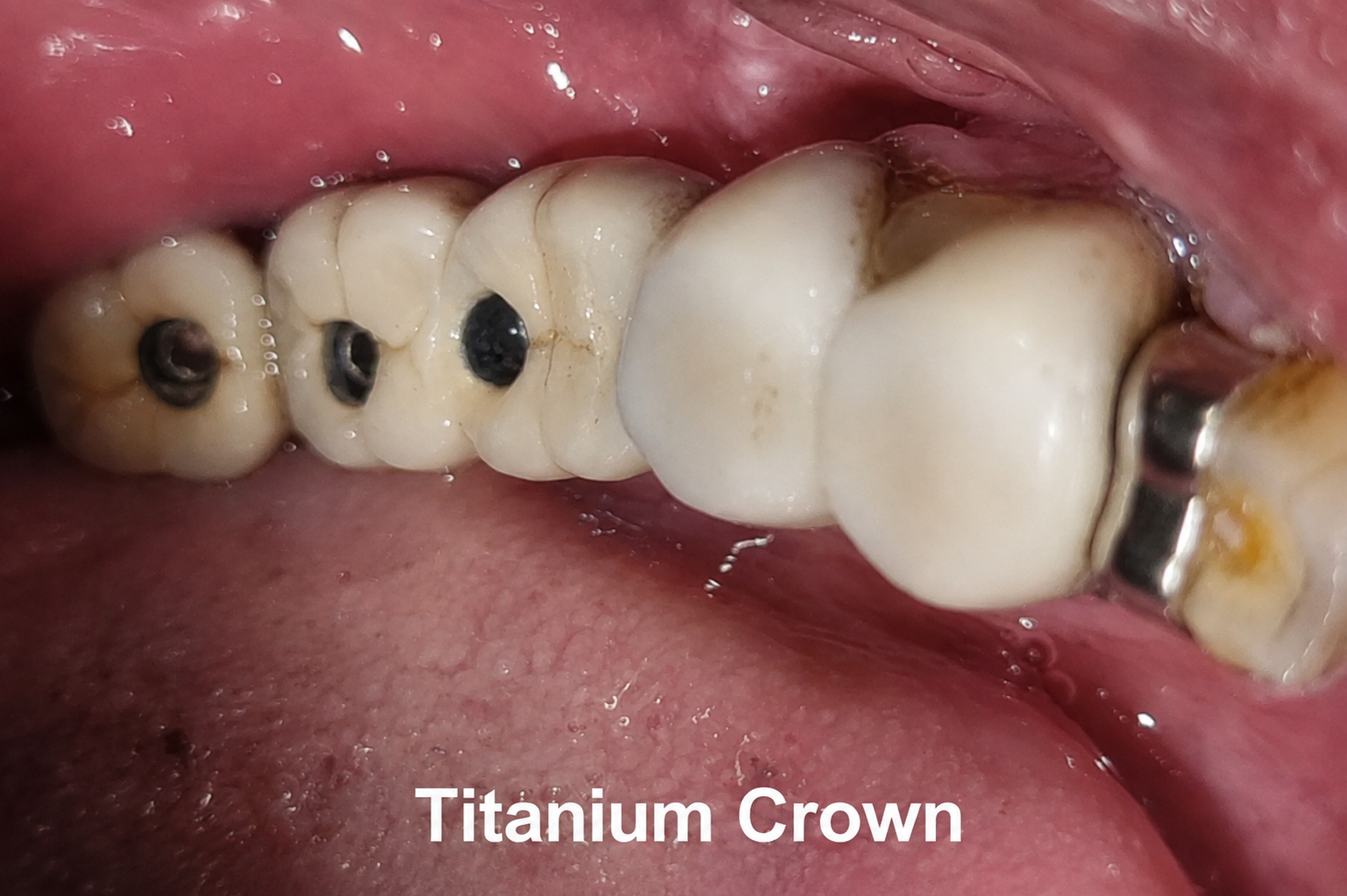 Sterile clinical diagnostic environment
