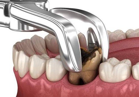 Advanced sterile surgical dental operatory
