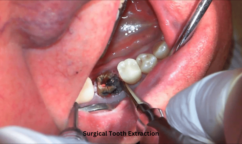 High-tech sterile clinical dental instruments
