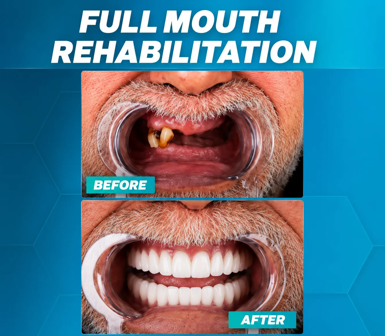 Advanced modern restorative dental operatory