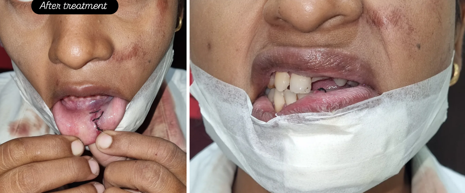 Sterile clinical diagnostic environment