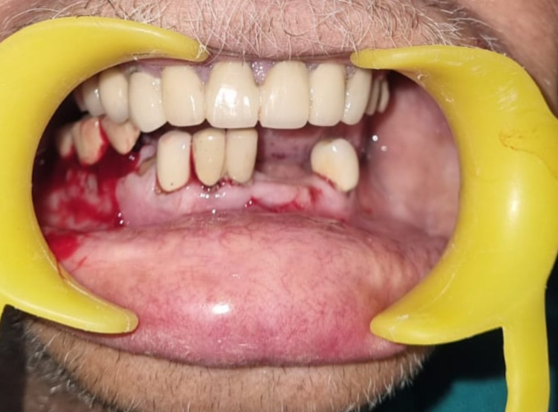 Sterile clinical diagnostic environment