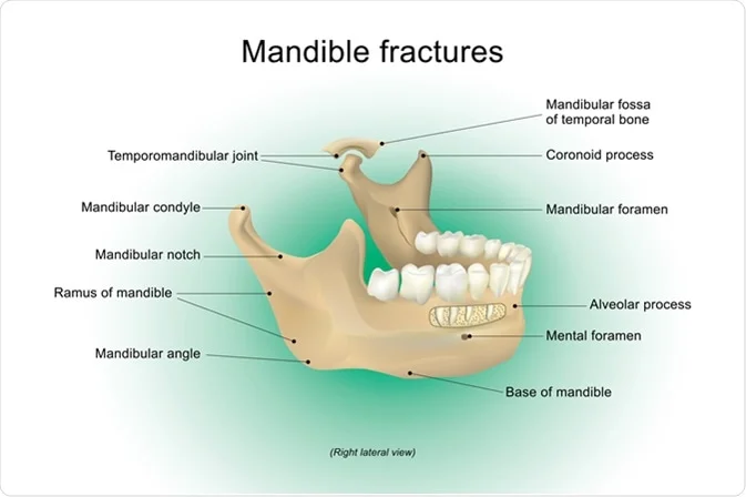 Maxillofacial surgical discussion and preparation