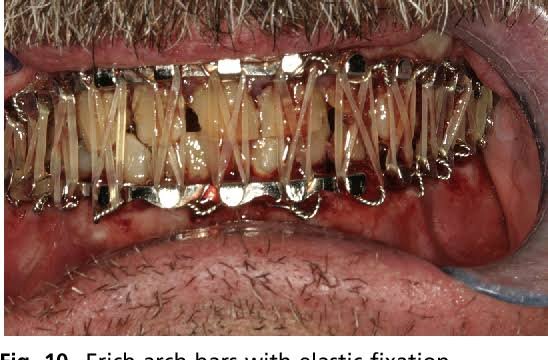 Maxillofacial surgical discussion and preparation