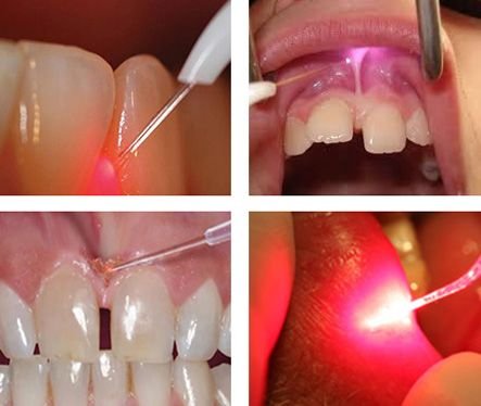 Sterile modern laser treatment operatory