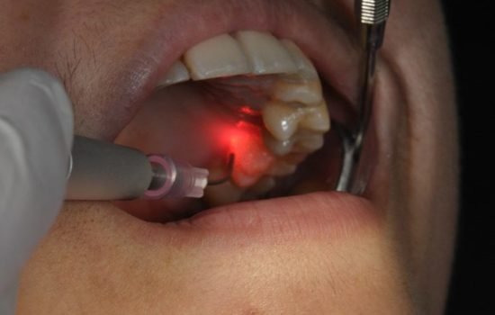 High-tech sterile clinical dental instruments
