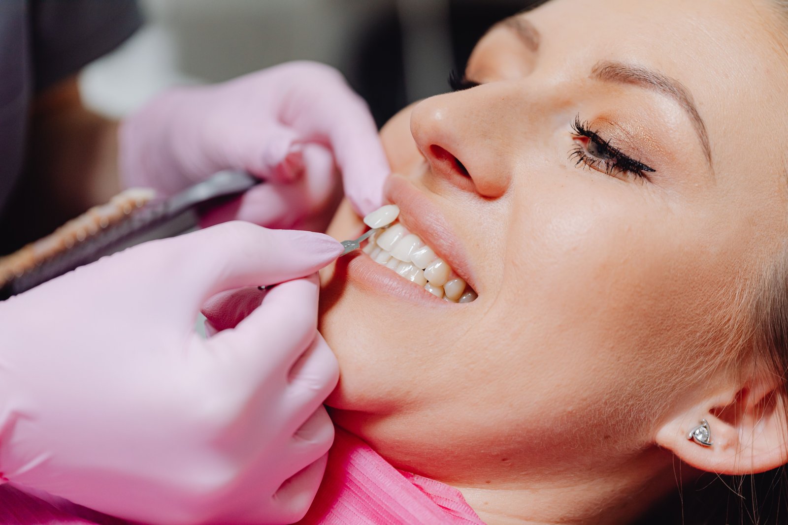 Specialized dentist performing cosmetic smile examination