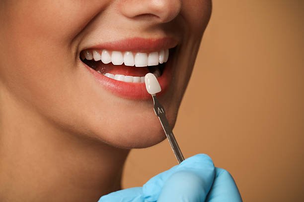 Advanced professional laser teeth whitening session