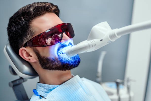 Advanced professional laser teeth whitening session
